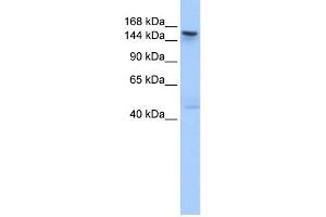 WB Suggested Anti-TEX14 Antibody Titration: 0. (TEX14 Antikörper  (C-Term))