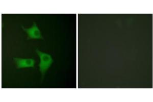 Immunofluorescence analysis of HeLa cells, using p15 INK antibody (ABIN5976476). (CDKN2B Antikörper  (C-Term))