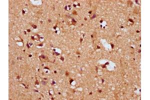IHC image of ABIN7169865 diluted at 1:200 and staining in paraffin-embedded human brain tissue performed on a Leica BondTM system. (SNRPE Antikörper  (AA 1-92))