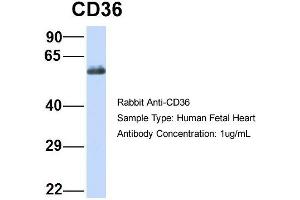 Host:  Rabbit  Target Name:  CD36  Sample Type:  Human Fetal Heart  Antibody Dilution:  1.