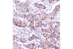 IHC analysis of CD2AP using anti-CD2AP antibody (ABIN6719544). (CD2AP Antikörper  (AA 253-337))