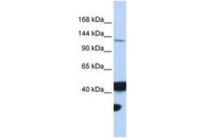 Image no. 1 for anti-MutL Homolog 3 (MLH3) (AA 1188-1237) antibody (ABIN6743100) (MLH3 Antikörper  (AA 1188-1237))