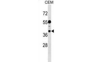 Western Blotting (WB) image for anti-Tumor Suppressing Subtransferable Candidate 1 (TSSC1) antibody (ABIN2999073) (TSSC1 Antikörper)