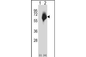 Western blot analysis of P2 (arrow) using rabbit polyclonal P2 Antibody (Center) (ABIN657616 and ABIN2846612). (MMP2 Antikörper  (AA 303-331))