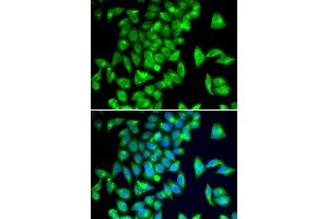 Immunofluorescence analysis of  cells using TPH2 antibody (ABIN6133469, ABIN6149436, ABIN6149437 and ABIN6222965). (Tryptophan Hydroxylase 2 Antikörper  (AA 1-170))