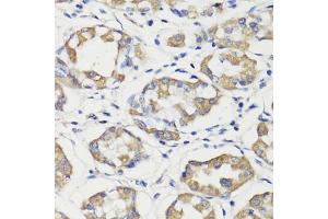 Immunohistochemistry of paraffin-embedded human stomach using DEPDC6 antibody (ABIN7266738) at dilution of 1:200 (40x lens).
