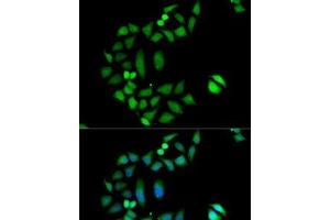 Immunofluorescence analysis of MCF7 cells using CLIC1 Polyclonal Antibody (CLIC1 Antikörper)