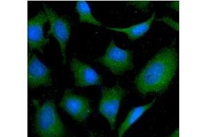 ICC/IF analysis of NAGK in HeLa cells line, stained with DAPI (Blue) for nucleus staining and monoclonal anti-human NAGK antibody (1:100) with goat anti-mouse IgG-Alexa fluor 488 conjugate (Green).