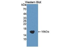 Western blot analysis of the recombinant protein. (ADAMTS1 Antikörper  (AA 854-967))