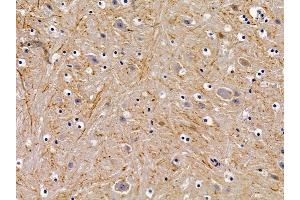 ABIN6258928 and ABIN6276017 at 1/100 staining mouse brain tissue by IHC-P. (GPR156 Antikörper  (Internal Region))