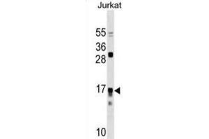 Western Blotting (WB) image for anti-Interleukin 17 Receptor C (IL17RC) antibody (ABIN3000332)