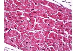 Anti-Podoplanin antibody IHC of human heart. (Podoplanin Antikörper  (AA 1-206))