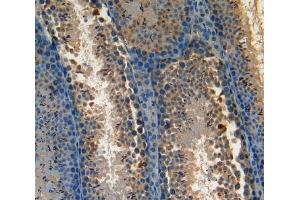 Used in DAB staining on fromalin fixed paraffin-embedded Kidney tissue (AATK Antikörper  (AA 137-386))