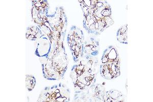 Immunohistochemistry (IHC) image for anti-Alanyl (Membrane) Aminopeptidase (ANPEP) (AA 668-967) antibody (ABIN6136911)