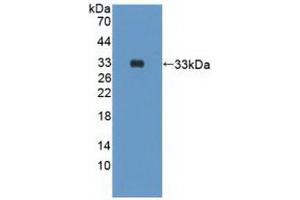 Detection of Recombinant PIK3Cd, Human using Polyclonal Antibody to Phosphoinositide-3-Kinase Catalytic Delta Polypeptide (PIK3Cd) (PIK3CD Antikörper  (AA 774-1044))