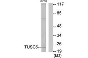 Western Blotting (WB) image for anti-Tumor Suppressor Candidate 5 (TUSC5) (AA 1-50) antibody (ABIN2889667) (TUSC5 Antikörper  (AA 1-50))
