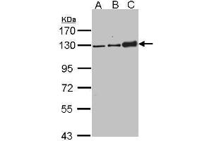 Desmoglein 2 Antikörper  (N-Term)