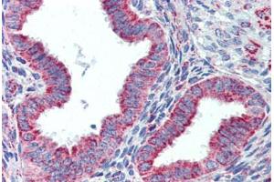 Human Uterus (formalin-fixed, paraffin-embedded) stained with HSPD1 antibody ABIN462365 followed by biotinylated anti-goat IgG secondary antibody ABIN481715, alkaline phosphatase-streptavidin and chromogen. (HSPD1 Antikörper)
