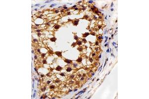 Immunohistochemical staining of paraffin-embedded human testis section reacted with FLT4 monoclonal antibody  at 1:25 dilution.