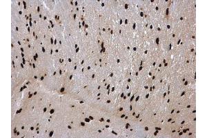 Immunohistochemistry (IHC) image for anti-Heterogeneous Nuclear Ribonucleoprotein C (C1/C2) (HNRNPC) antibody (ABIN2856905)