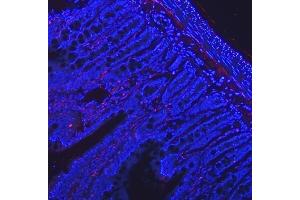 anti-Vasoactive Intestinal Peptide (Vip) (AA 81-107), (Middle Region) antibody