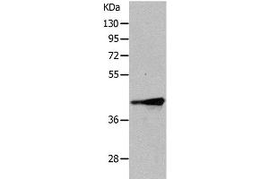 Western Blot analysis of Human fetal muscle tissue using TRIM63 Polyclonal Antibody at dilution of 1:1050 (TRIM63 Antikörper)