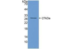 Detection of Recombinant TIGIT, Mouse using Polyclonal Antibody to T-Cell Immunoreceptor With Ig And ITIM Domains Protein (TIGIT) (TIGIT Antikörper  (AA 28-246))