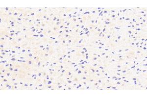 Detection of CFI in Human Cardiac Muscle Tissue using Polyclonal Antibody to Complement Factor I (CFI) (Complement Factor I Antikörper  (AA 28-243))