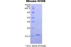 SDS-PAGE (SDS) image for Inducible T-Cell Co-Stimulator (ICOS) (AA 35-131) protein (His tag) (ABIN1877427) (ICOS Protein (AA 35-131) (His tag))