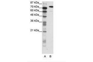 Image no. 1 for anti-SATB Homeobox 1 (SATB1) (C-Term) antibody (ABIN202904) (SATB1 Antikörper  (C-Term))