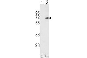 Western Blotting (WB) image for anti-SMAD Family Member 4 (SMAD4) antibody (ABIN3003471) (SMAD4 Antikörper)