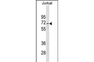 Western blot analysis in Jurkat cell line lysates (35ug/lane). (JRKL Antikörper  (C-Term))