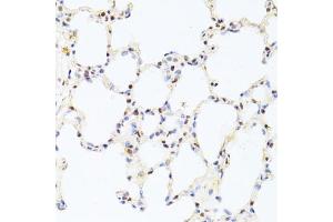 Immunohistochemistry of paraffin-embedded rat lung using CREB1 antibody (ABIN6290133) at dilution of 1:100 (40x lens). (CREB1 Antikörper)
