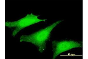 Immunofluorescence of monoclonal antibody to SVIL on HeLa cell.