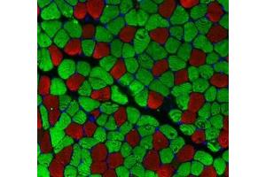 Immunofluorescent analysis of paraformaldehyde-fixed mouse skeletal muscle using MYH1 (, red) and MYH7 (ABIN7075623, green) at dilution of 1: 100 (Slow Skeletal Myosin Heavy Chain Antikörper)