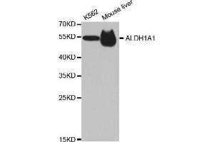 Western blot analysis of extracts of various cell lines, using ALDH1A1 antibody. (ALDH1A1 Antikörper  (AA 48-147))