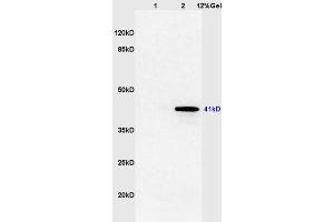 Lane 1: mouse brain lysates Lane 2: mouse thyroid lysates probed with Anti TTF-2/FOXE1 Polyclonal Antibody, Unconjugated (ABIN668721) at 1:200 in 4 °C. (FOXE1 Antikörper  (AA 101-200))