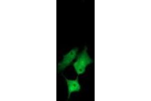 Image no. 2 for anti-Chaperonin Containing TCP1, Subunit 8 (Theta)-Like 2 (CCT8L2) antibody (ABIN1497480) (CCT8L2 Antikörper)