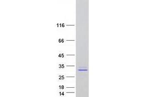 Western Blotting (WB) image for Prolactin (PRL) (Transcript Variant 2) protein (Myc-DYKDDDDK Tag) (ABIN2729746)
