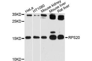 Western blot analysis of extracts of various cell lines, using RPS20 antibody (ABIN4905052) at 1:1000 dilution. (RPS20 Antikörper)