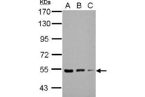WB Image Sample (30 ug of whole cell lysate) A: NIH-3T3 B: JC C: BCL-1 7. (KBTBD4 Antikörper  (Center))