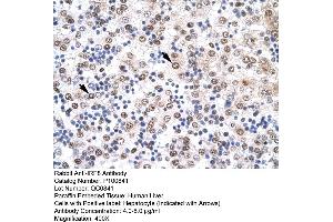 Immunohistochemistry with Human Liver cell lysate tissue (IRF8 Antikörper  (N-Term))