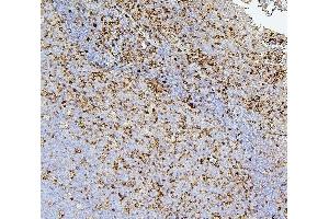 IHC analysis of CD43 using anti-CD43 antibody (ABIN7601042). (CD43 Antikörper  (AA 272-400))