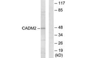 Western Blotting (WB) image for anti-Cell Adhesion Molecule 2 (CADM2) (AA 131-180) antibody (ABIN2889890) (CADM2 Antikörper  (AA 131-180))