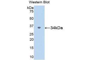 Western blot analysis of the recombinant protein. (SPARC Antikörper  (AA 18-301))