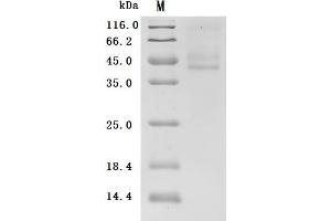 (Tris-Glycine gel) Discontinuous SDS-PAGE (reduced) with 5 % enrichment gel and 15 % separation gel.
