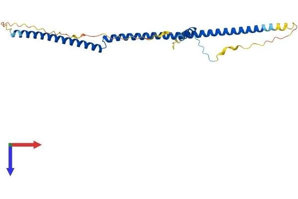BRMS1 Protein (AA 1-246) (His tag)