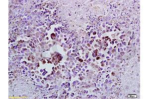 Formalin-fixed and paraffin embedded mouse lymphoma tissue labeled with Anti-Cyclin A2 Polyclonal Antibody (ABIN670281), Unconjugated at 1:100, followed by conjugation to the secondary antibody and DAB staining (Cyclin A Antikörper  (AA 375-431))