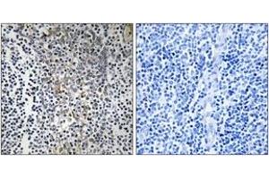 Immunohistochemistry analysis of paraffin-embedded human tonsil tissue, using RPL23 Antibody. (RPL23 Antikörper  (AA 51-100))