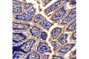 IHC analysis of NMU using anti-NMU antibody (ABIN5692905).